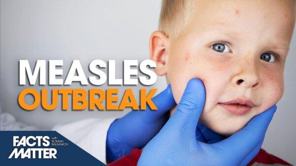 Outbreak of Measles Across US; CDC Reports 100 Percent Spike in Cases Over Just 2 Weeks | Facts Matter